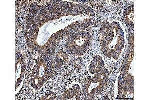 IHC analysis of TRMT61B using anti-TRMT61B antibody (ABIN7602334). (TRMT61B anticorps  (AA 7-477))
