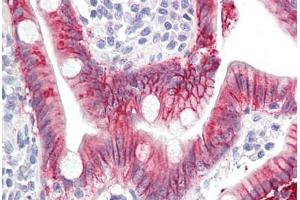 Image no. 3 for anti-Interleukin 17A (IL17A) (AA 1-75) antibody (ABIN1490779)