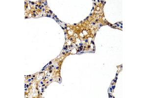 Immunohistochemistry of paraffin-embedded rat lung using MT2A antibody at dilution of 1:200 (400x lens). (MT2A anticorps)