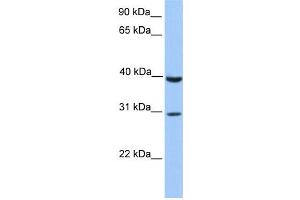 Western Blotting (WB) image for anti-JAZF Zinc Finger 1 (JAZF1) antibody (ABIN2458461) (JAZF1 anticorps)