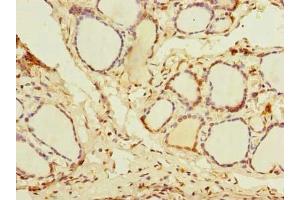 Immunohistochemistry of paraffin-embedded human thyroid tissue using ABIN7144994 at dilution of 1:100 (DDX5 anticorps  (AA 1-210))