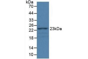 Detection of Recombinant FBLN1, Rat using Monoclonal Antibody to Fibulin 1 (FBLN1) (Fibulin 1 anticorps)