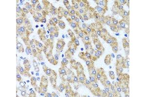 Immunohistochemistry of paraffin-embedded Human liver damage using INADL Polyclonal Antibody at dilution of 1:100 (40x lens). (PATJ anticorps)