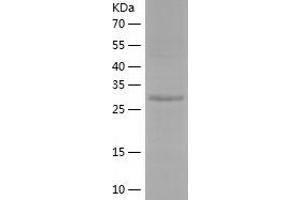 Western Blotting (WB) image for AlkB, Alkylation Repair Homolog 2 (ALKBH2) (AA 1-261) protein (His tag) (ABIN7121792)