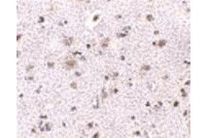 Immunohistochemistry (IHC) image for anti-Brain and Reproductive Organ-Expressed (TNFRSF1A Modulator) (BRE) (N-Term) antibody (ABIN1031282) (BRE anticorps  (N-Term))