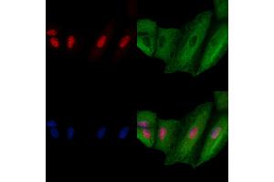 ABIN6264927 and ABIN6278743 staining  cells by IF/ICC. (SART3 anticorps  (C-Term))