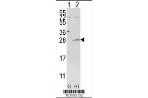 Western blot analysis of AK3 using rabbit polyclonal AK3 Antibody (C-term H38) using 293 cell lysates (2 ug/lane) either nontransfected (Lane 1) or transiently transfected with the AK3 gene (Lane 2). (Adenylate Kinase 3 anticorps  (C-Term))