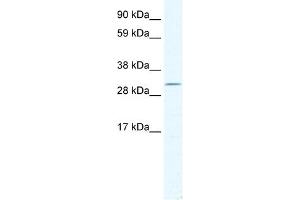 WB Suggested Anti-DMRT2 Antibody Titration:  2. (DMRT2 anticorps  (C-Term))