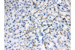IHC testing of FFPE rat liver with ABCB11 antibody.