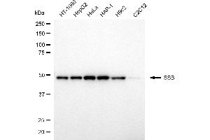 anti-Sjogren Syndrome Antigen B (SSB) antibody