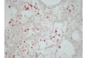 Image no. 1 for anti-CD163 (CD163) antibody (ABIN379967) (CD163 anticorps)