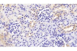 Detection of VAV1 in Mouse Kidney Tissue using Polyclonal Antibody to Vav 1 Oncogene (VAV1) (VAV1 anticorps  (AA 565-795))