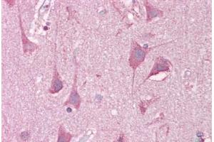 Anti-LRRTM2 antibody IHC staining of human brain, cortex. (LRRTM2 anticorps  (C-Term))