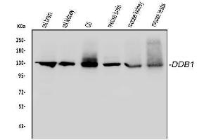 Western blot analysis of DDB1 using anti-DDB1 antibody (ABIN3043823). (DDB1 anticorps  (AA 1011-1140))