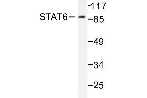 Image no. 1 for anti-Signal Transducer and Activator of Transcription 6, Interleukin-4 Induced (STAT6) antibody (ABIN271832) (STAT6 anticorps)