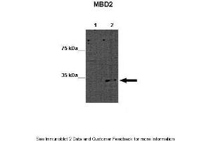 Lanes:   Lane 1: 15ug WT mouse ES lysate Lane 2: 15ug MBD2 KO mouse ES lysate  Primary Antibody Dilution:   1:1000  Secondary Antibody:   Goat anti-rabbit-HRP  Secondary Antibody Dilution:   1:2500  Gene Name:   MBD2 a  Submitted by:   Austin J. (MBD2 anticorps  (Middle Region))