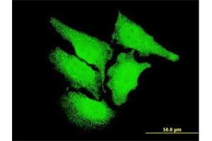 Immunofluorescence of monoclonal antibody to CAMK2D on HeLa cell. (CAMK2D anticorps  (AA 301-410))