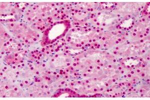 Human Kidney: Formalin-Fixed, Paraffin-Embedded (FFPE)