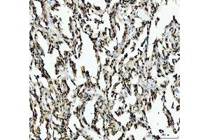 IHC analysis of SFPQ using anti-SFPQ antibody (ABIN7603089). (SFPQ anticorps  (Middle Region))