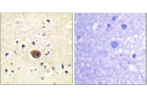 Immunohistochemistry analysis of paraffin-embedded human brain tissue, using Ras-GRF1 (Ab-916) Antibody. (RASGRF1 anticorps  (AA 882-931))