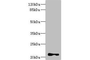 Western blot All lanes: TNNI2 antibody at 3. (TNNI2 anticorps  (AA 1-100))