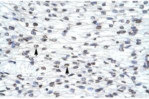 anti-LIM Homeobox 3 (LHX3) (Middle Region) antibody