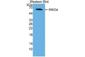 Western blot analysis of the recombinant protein. (Fibrillin 2 anticorps  (AA 1550-1791))