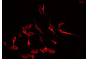 ABIN6266774 staining Hela by IF/ICC. (ATG4B anticorps  (Internal Region))