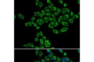 Immunofluorescence analysis of HeLa cells using SRPK1 Polyclonal Antibody (SRPK1 anticorps)