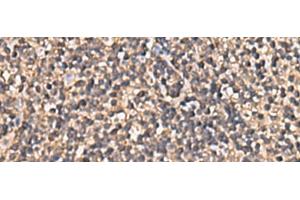 Immunohistochemistry of paraffin-embedded Human tonsil tissue using PLEKHF2 Polyclonal Antibody at dilution of 1:90(x200)