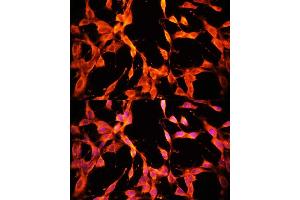 Immunofluorescence analysis of NIH/3T3 cells using MSP/MST1 antibody (ABIN6132374, ABIN6144095, ABIN6144096 and ABIN6216790) at dilution of 1:100.