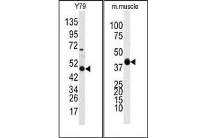 Image no. 1 for anti-Aldehyde Dehydrogenase 3 Family, Member A1 (ALDH3A1) (Middle Region) antibody (ABIN360203)