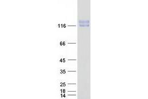 Validation with Western Blot