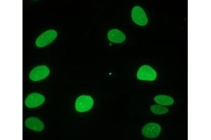 Immunocytochemical staining of fiboblasts showing nuclear lamina (Lamin A/C anticorps)