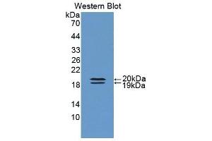 Detection of Recombinant FABP9, Rat using Polyclonal Antibody to Fatty Acid Binding Protein 9, Testis (FABP9) (FABP9 anticorps  (AA 1-130))