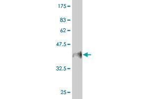 Western Blot detection against Immunogen (37.