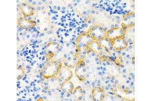 Immunohistochemistry of paraffin-embedded Rat kidney using STC1 Polyclonal Antibody at dilution of 1:100 (40x lens). (Stanniocalcin 1 anticorps)