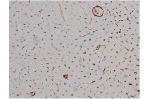 ABIN6267511 at 1/200 staining Mouse heart tissue sections by IHC-P. (STAT6 anticorps  (pThr645))