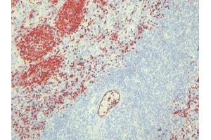 Immunohistochemistry (IHC) image for anti-Endothelial Cells antibody (ABIN781798) (Endothelial Cells anticorps)