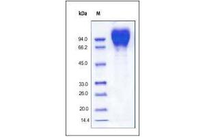 HIV-1 (CN54) GP120 on SDS-PAGE under reducing (R) condition.