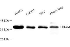 Western blot analysis of ODAM (ABIN7074940) at dilution of 1: 500 (ODAM anticorps)