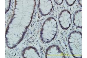 Image no. 1 for anti-Phosphoglucomutase 3 (PGM3) (AA 1-543) antibody (ABIN598868) (Phosphoglucomutase 3 anticorps  (AA 1-543))