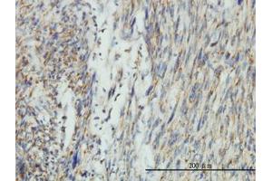 Image no. 1 for anti-Dynamin 1-Like (DNM1L) (AA 1-711) antibody (ABIN599113) (Dynamin 1-Like anticorps  (AA 1-711))