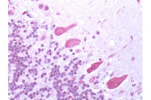 Human Brain, Cerebellum: Formalin-Fixed, Paraffin-Embedded (FFPE) (Bestrophin 3 anticorps  (Cytoplasmic Domain))