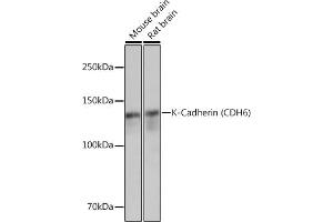 Western blot analysis of extracts of various cell lines, using K-Cadherin (CDH6) Rabbit mAb (ABIN1680831, ABIN3019147, ABIN3019148 and ABIN7101722) at 1:3000 dilution. (CDH6 anticorps)