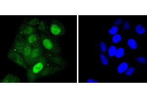 HeLa cells were stained with STAT5a (6E5) Monoclonal Antibody  at [1:200] incubated overnight at 4C, followed by secondary antibody incubation, DAPI staining of the nuclei and detection.