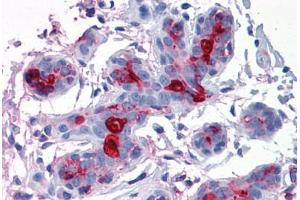 Breast, Human: Formalin-Fixed, Paraffin-Embedded (FFPE)