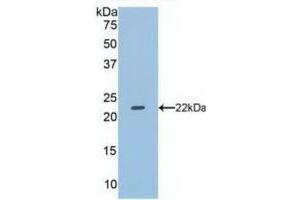 Western blot analysis of recombinant Human DUSP3. (Dual Specificity Phosphatase 3 (DUSP3) (AA 2-185) anticorps)
