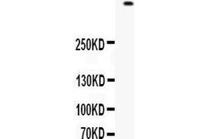 Western blot analysis of Filaggrin expression in 22RV1 whole cell lysates (lane 1). (Filaggrin anticorps  (AA 1-261))