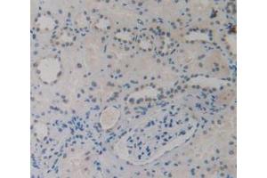 IHC-P analysis of Human Kidney Tissue, with DAB staining. (EBI3 anticorps)